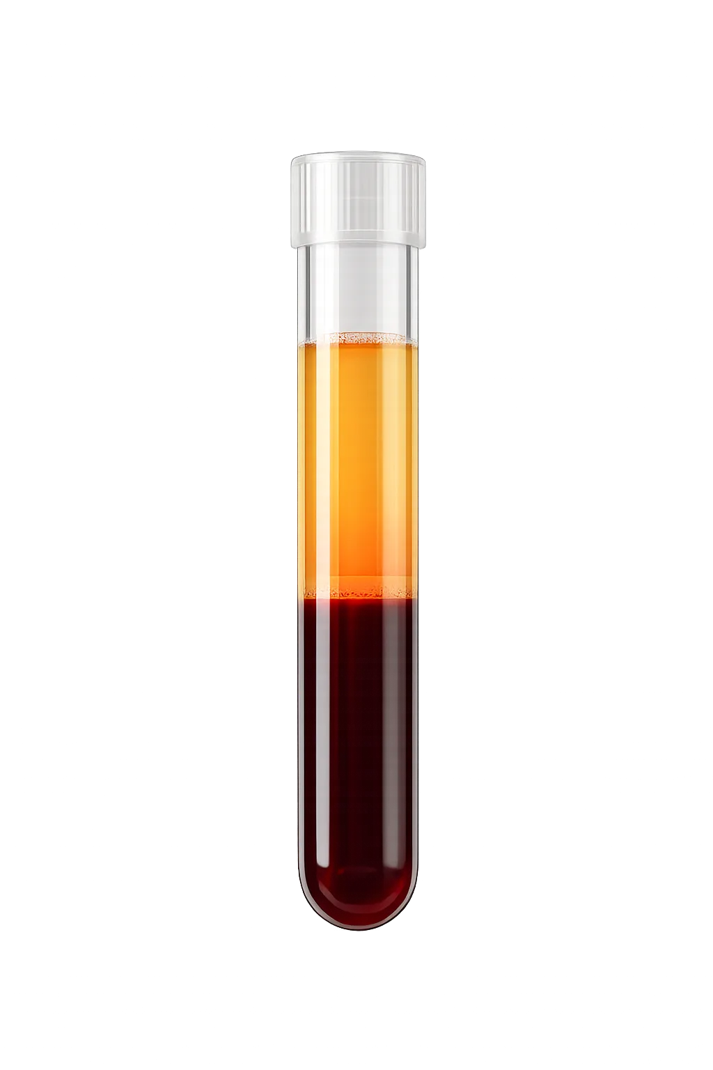 Plättchenreiches Plasma